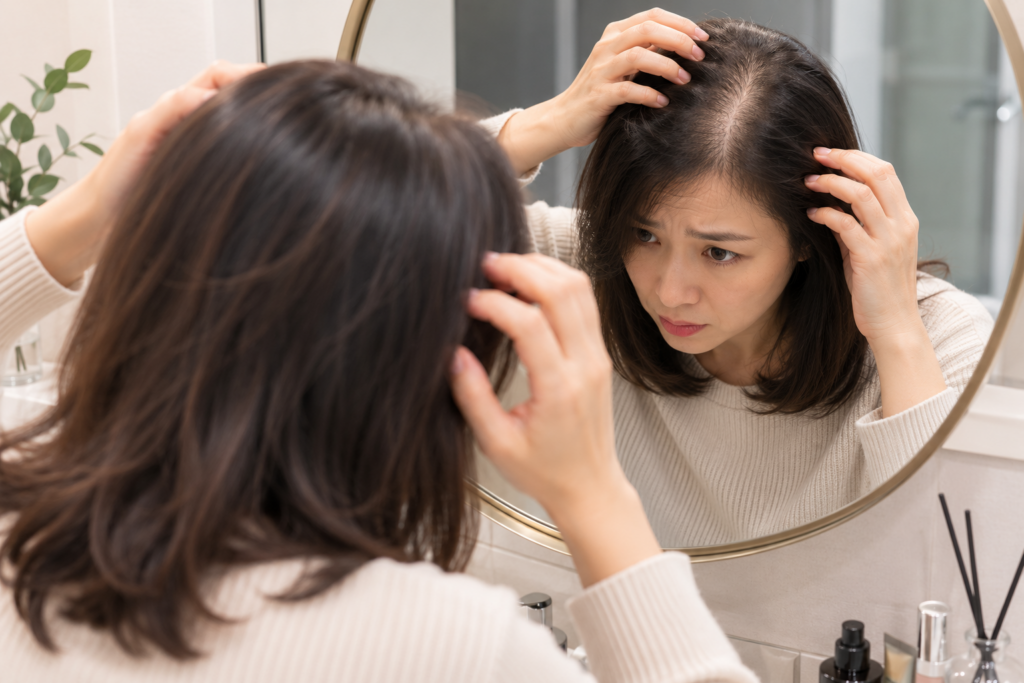 대전두피문신-추천-가르마탈모-두피비침